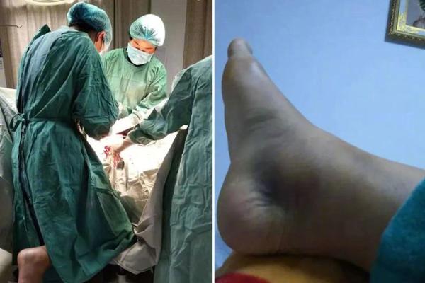 刘诗诗台北顺利产子 吴奇隆报喜：母子平安_CN2容灾备份