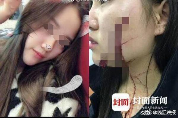 “娃娃音”同框!林志玲与丫头合影被指认不出