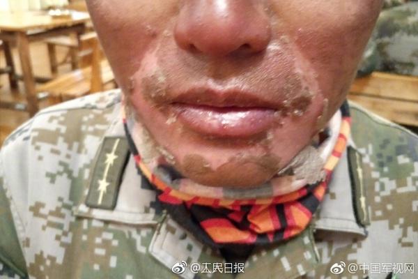人工智能足彩23中18!小联赛如何分析?数据告诉你