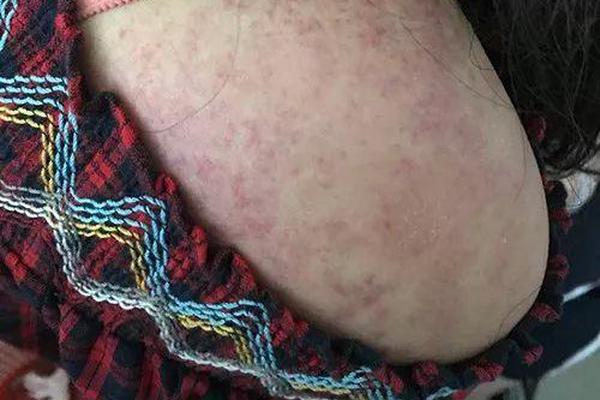 姐妹被洪水卷走警方拒立案_香港CN2线路